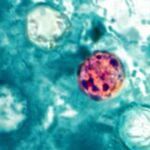 México confirma tres casos de Cyclospora; Salud descarta brote en el país
